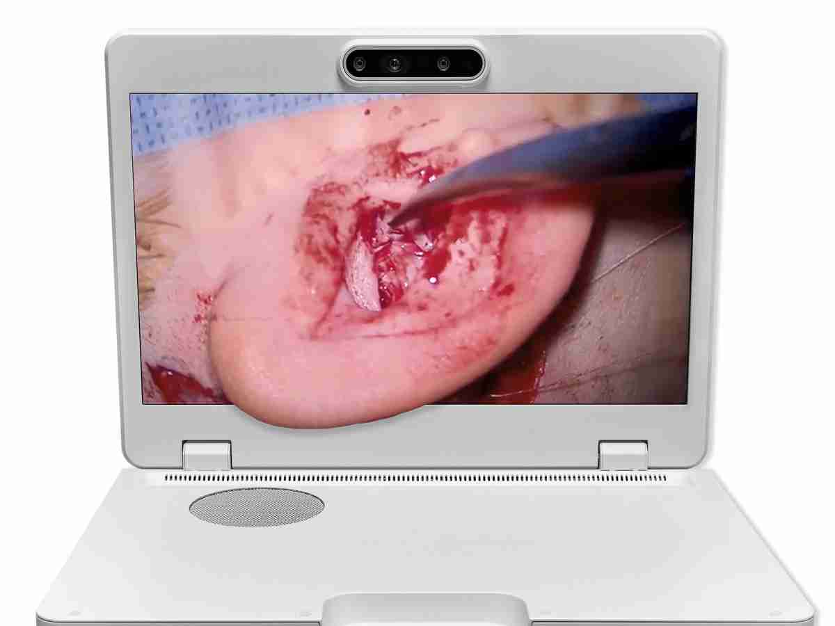 达擎之＂Heads-up 3D显微手术显示系统＂，，，整合4K裸眼3D显示及眼球追踪系统，，具备快速追踪人眼移动位置功能，，，，减轻医师长时间维持固定姿势的负担，，，让医师能有更宽广清晰的3D立体视野及更舒适的姿势来执行手术。。。